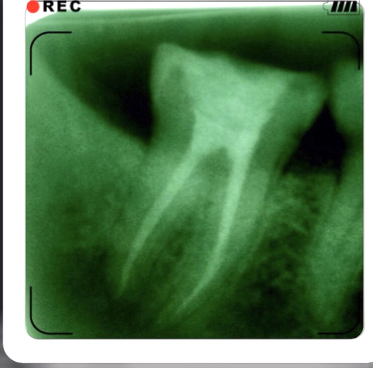 Wethersfield Cosmetic Dentist