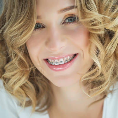 Wellness Dental Care | Dental Sealants, VELscope reg  Cancer Screening and All-on-4 reg 